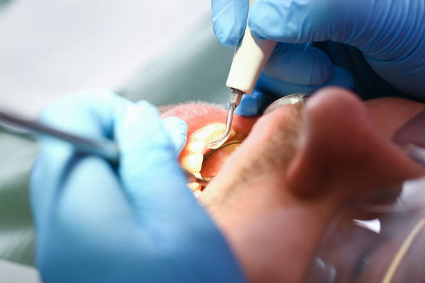 Best Emergency Tooth Extraction in Archbald, PA