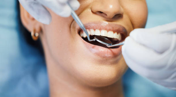 Best Emergency Wisdom Teeth Removal in Archbald, PA